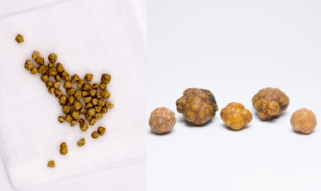 small stones